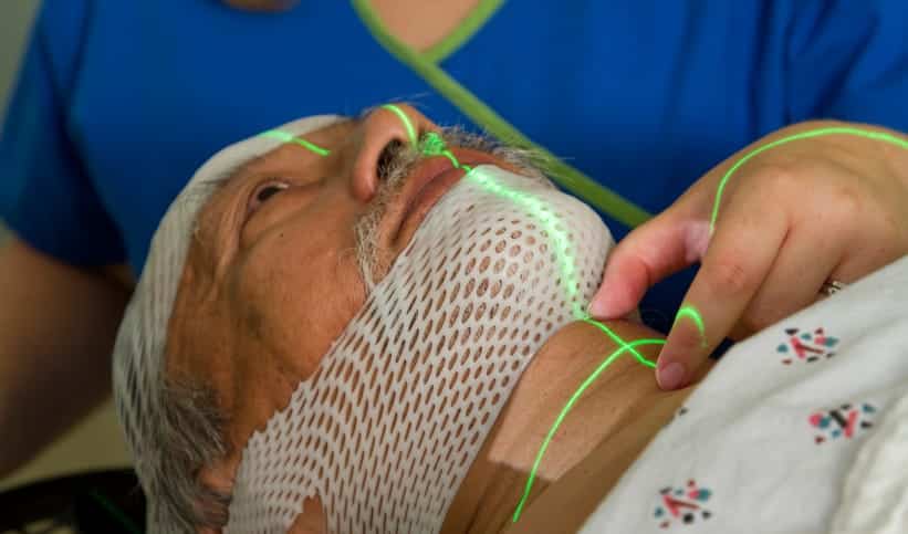 Peut-on prévoir les effets secondaires de la radiothérapie